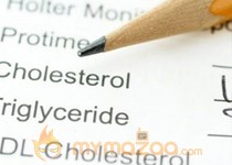 12 tips to reduce high cholesterol