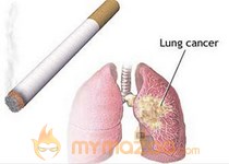Air pollution tied to lung cancer in non-smokers 