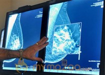 Earliest breast cancer risky for some women, study suggests