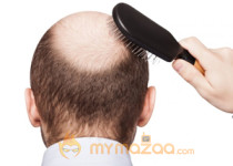 Top Home Remedies To Get Rid Of Baldness