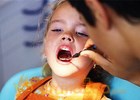 Special needs kid: 10 simple solutions for healthy teeth