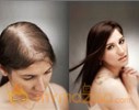 A Guide to Female Hair Loss