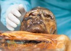 Iceman Otzi's gut bug sheds light on human migration