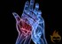 Elite athletes at greater risk for arthritis: study 