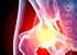 New surgical technique allows for outpatient hip replacement surgery