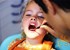 Special needs kid: 10 simple solutions for healthy teeth