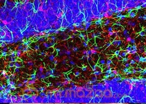 Blocking brain inflammation 'halts Alzheimer's disease'