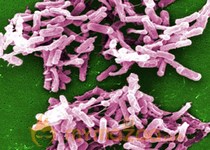 Toxic gut bacteria: New treatment could prevent repeat infections