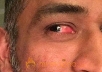 When Dhoni played Cricket with Blurred Vision?