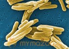 35 people test positive for tuberculosis at El Paso school
