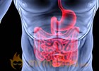 Blacks may be less likely to get chemo for advanced colon cancer