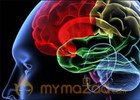 Brain analysis can help predict psychosis: study 