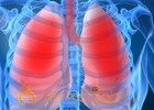 FDA clears drug for leading form of cystic fibrosis