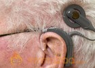 Gene therapy may boost power of cochlear implants, study says