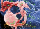 Russian to double spending on HIV care next year