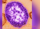 Washington woman's measles death is first in US since 2003