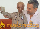 15-Year-Old Nihal Bitla, The Face Of Progeria In India, Passes Away In Telangana