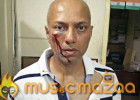 Telugu Music Director attacked by Neighbour