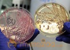 E. coli could be answer to antibiotic-resistant bacteria, scientists say