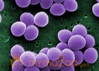 Super-superbugs: Antibiotic-resistant bacteria may be deadlier