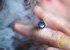 Adolescent e-cigarette use tied to breathing problems