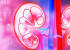 Air Pollution May Cause Kidney Disease