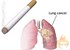Air pollution tied to lung cancer in non-smokers 