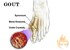 Causes Of Gout