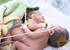 Conjoined twin babies shifted to NICH Karachi 
