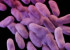 Deadly superbug arrives in US, report says