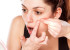 Easy tips to keep acne at bay!