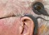 Gene therapy may boost power of cochlear implants, study says