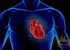 Life-saving prescriptions lagging in heart patients 