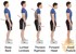 5 Ways Poor Posture Can Limit Height Growth