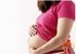 Endometriosis and Pregnancy