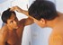 Treatment for baldness: Australian scientists discover key gene  